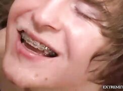 A Smiling Young Twink, Who Likes To Receive Sperm On His Braces, To Swallow it .